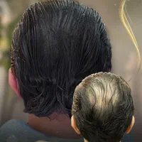میکرواسکالپ / اسکالپ تخصصی سر/ جایگزین کاشت مو|خدمات آرایشگری و زیبایی|مشهد, وکیل‌آباد|دیوار