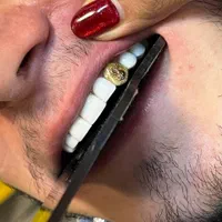 جشنواره کامپوزیت لمینیت عصب IPS IMAX روکش N2 ونیر|خدمات آرایشگری و زیبایی|تهران, هفت حوض|دیوار