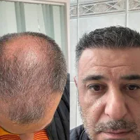 کاشتمو شیراز با شرایط اقساط|خدمات آرایشگری و زیبایی|شیراز, قدوسی شرقی|دیوار