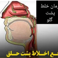 درمان خلط پشت حلق