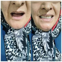 جشنواره دندان مصنوعی خارجی ژله ای با بیمه وضمانت|خدمات آرایشگری و زیبایی|کرج, مصباح|دیوار