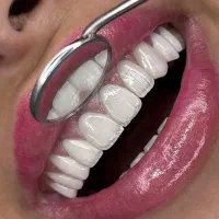 لمینت، کامپوزیت و خدمات زیبایی دندانپزشکی