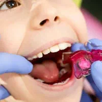 ارتودنسی اطفال