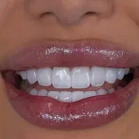 جشنواره ایمپلنت و دندانپزشکی با شرایط ویژه