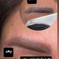 دستگاه کیوسوئیچ جهت ریمو تتو،رفع تیرگی ،کربن تراپی|آرایشی، بهداشتی، درمانی|کرج, فاز ۱ مهرشهر|دیوار