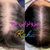 ژل/بوتاکس/آنزیم/مزو فقط ۳۰۰|خدمات آرایشگری و زیبایی|کرج, گوهردشت|دیوار