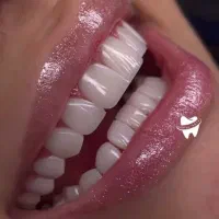 دندانپزشکی پذیرش آنلاین بیمه های تکمیلی و آزاد
