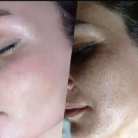 کرم روشن کننده و ضدلک صددرصد تضمینی وایت رز
