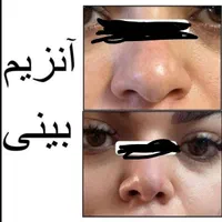 انزیم بینی|خدمات آرایشگری و زیبایی|الشتر, |دیوار