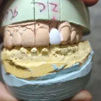 لابراتوار دندانسازی (روکش ثابت)|پزشکی|کرمانشاه, |دیوار