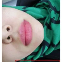 شیدینگ لب|خدمات آرایشگری و زیبایی|قائن, |دیوار