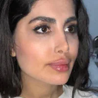 تزریق ژل و بوتاکس، لیزر ،هایفو اندولیفت فیلر بادی|خدمات آرایشگری و زیبایی|کرج, مهرویلا جنوبی|دیوار