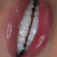 بازاریاب دندانپزشکی