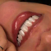 کامپوزیت نقد و اقساط