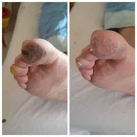 کارشناس زخم و پرستاری