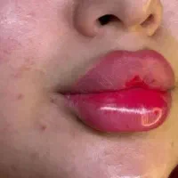 آموزش لاینهای آرایشگری وژل و بوتاکس مدل هم میخاییم