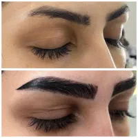 لابیاپلاستی/واژینوپلاستی/بوکال فت/ساکشن غبغب/کاشت|خدمات آرایشگری و زیبایی|تهران, فرمانیه|دیوار