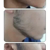 با پکای ما رویش ریشو سیبلتو فضایی کن