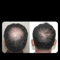 صابون خارجی|آرایشی، بهداشتی، درمانی|تهران, بهمن یار|دیوار
