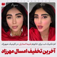 ژل لب با متد M تکنیک مهرزاد|خدمات آرایشگری و زیبایی|تهران, اباذر|دیوار