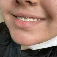 آموزش وخدمات میکرودرمال پرسینگ نگین دندان چال لپ|خدمات زیبایی و سلامت|اصفهان, شاهد|دیوار