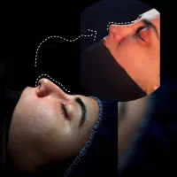 جراحی بینی|خدمات آرایشگری و زیبایی|کرج, کمال‌شهر|دیوار