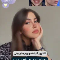 اف زیبایی بینی و لیپو|خدمات آرایشگری و زیبایی|اهواز, کیانپارس |دیوار