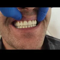 خدمات دندان مصنوعی (پروتز متحرک)|آرایشی، بهداشتی، درمانی|پارسآباد, |دیوار