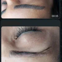 مدل فوری ریموو تتوی قدیمی وبدرنگ|خدمات آرایشگری و زیبایی|آمل, |دیوار