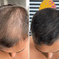 موهات مثل چمن پرپشت میشه