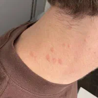 سمپاشی ساس سم پاشی و ریشه کنی سوسک موش مورچه کنه|خدمات نظافت|تهران, نیروی هوایی (پیروزی)|دیوار