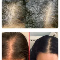 رشت آنی موی سر