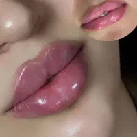 تخفیف ویژه،اموزش تزریقات ژل،فیلرو بوتاکس|خدمات آموزشی|تهران, دریاچه شهدای خلیج فارس|دیوار
