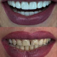 دندانپزشکی اقساطی و طرف قرارداد با بیمه