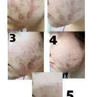 صفرتاصد پاکسازی پوست و فیشیال|خدمات آموزشی|تهران, پاسداران|دیوار