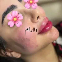 ژل و بوتاکس - مدلنیگ عربی-آموزش حرفه ای|خدمات آرایشگری و زیبایی|شیراز, شهرک مهرگان|دیوار