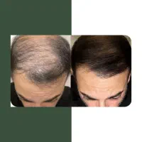 معجزه رویش