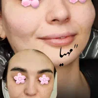 فیلر و بوتاکس وانزیم فیلر|خدمات آرایشگری و زیبایی|قم, دروازه چوبی|دیوار