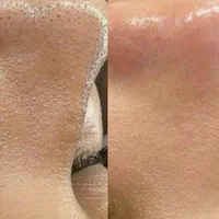 مرکز زیبایی نوژا (تخفیف پلاژن تراپی و میکروکارنت )|خدمات آرایشگری و زیبایی|جهرم, |دیوار