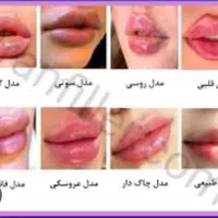 جشنواره تابستانه تزریق ژل و بوتاکس|خدمات آرایشگری و زیبایی|کرج, خرمدشت|دیوار