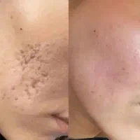فرصت محدود|آرایشی، بهداشتی، درمانی|مسجد سلیمان, |دیوار