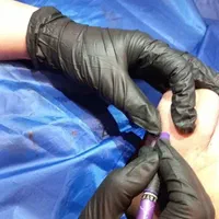 الکترولیز موی سفید وسیاه صورت بانوان فقط|خدمات آرایشگری و زیبایی|بروجرد, |دیوار