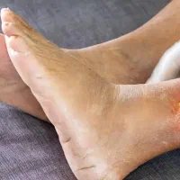 دیابت|خدمات زیبایی و سلامت|اهواز, کیانپارس |دیوار