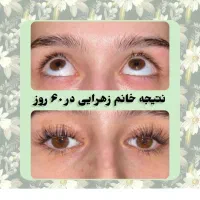 مژه و ابروتو طبیعی و دائمی زیبا کن|آرایشی، بهداشتی، درمانی|کیش, |دیوار