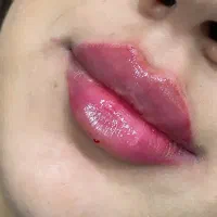 تزریق ژل بوتاکس تاتو پیرسینگ مژه و ...|خدمات آرایشگری و زیبایی|اهواز, پردیس|دیوار