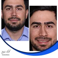 ویژه ترین جشنواره عمل بینی|خدمات زیبایی و سلامت|اصفهان, تیران|دیوار