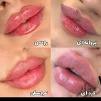 تخصص ما لیزر ژل و بوتاکس حرفه ای و جوانسازی پوست