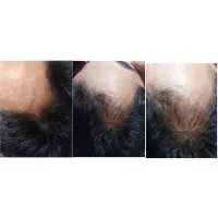 مو|آرایشی، بهداشتی، درمانی|تهران, فردوسی|دیوار