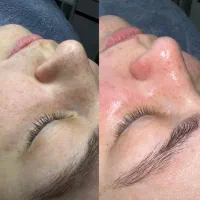 فیشیال|خدمات آرایشگری و زیبایی|شیراز, گلشن|دیوار