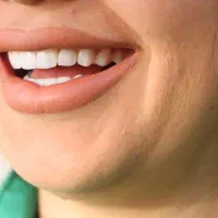 تخفیف ویژه و اقساط خدمات دندانپزشکی